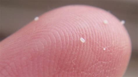 What Is The Difference Between Flea Eggs And Dandruff Pestwiki