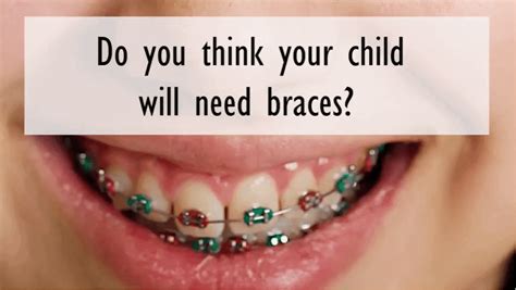 How To Tell If Your Child Needs Braces Families Magazine