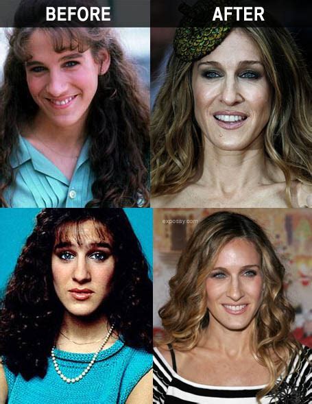 chatter busy sarah jessica parker nose job