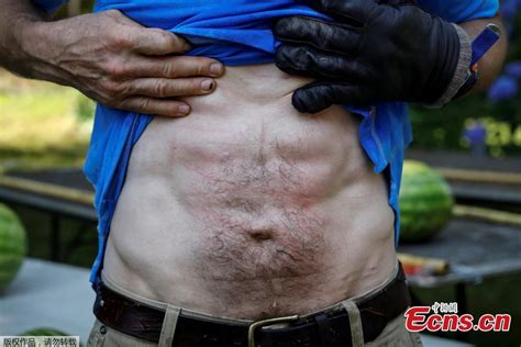 Man Challenges Guinness Record For Slicing Watermelons On Stomach