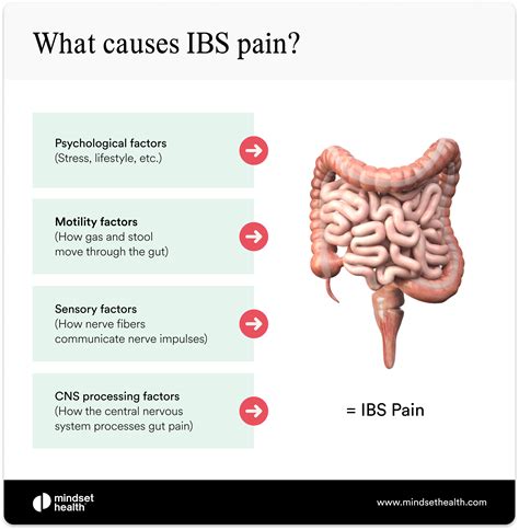 Ibs Pain Guide Types Locations And Treatments