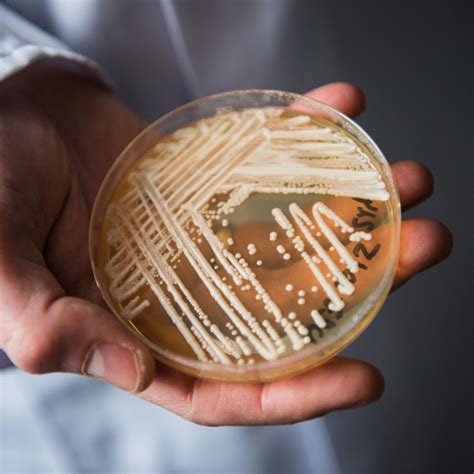 Cdc Warns About The Spread Of The Deadly Fungal Infection At An