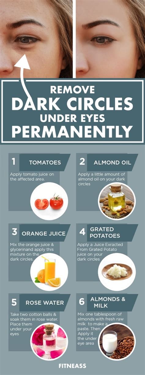 How To Remove Dark Circles Under Eyes Permanently Fitneass