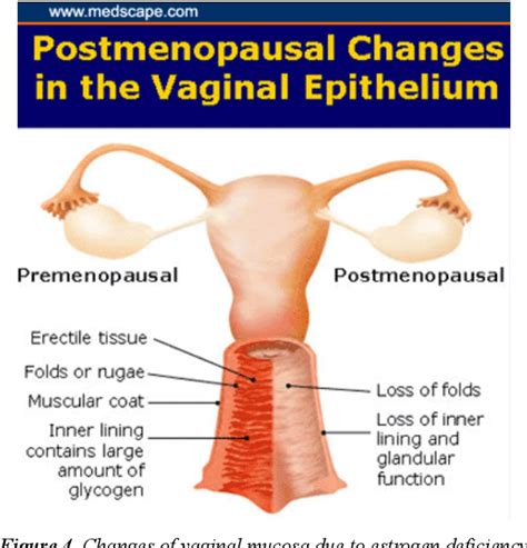 Pdf Genito Urinary Syndrome Of Menopause Gsm Or Vulvo Vaginal Atrophy Vva An Unspoken