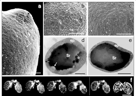 SEM micrographs showing enlarged images of sand fly SGs of P. sergenti.... | Download Scientific ...