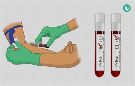 एचआईवी टेस्ट क्या है खर्च कब क्यों कैसे होता है hiv test price cost online booking in hindi