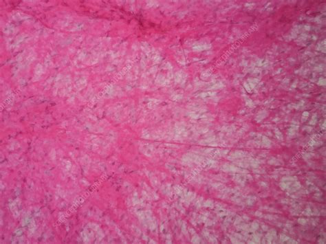 Human Areolar Tissue Light Micrograph Stock Image F032 3295