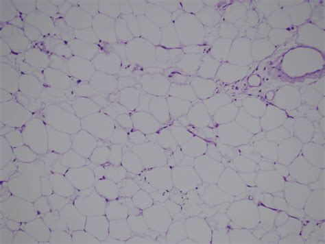 Lipid Filled Adipose Tissue Cell Loose Connective Tissue Download