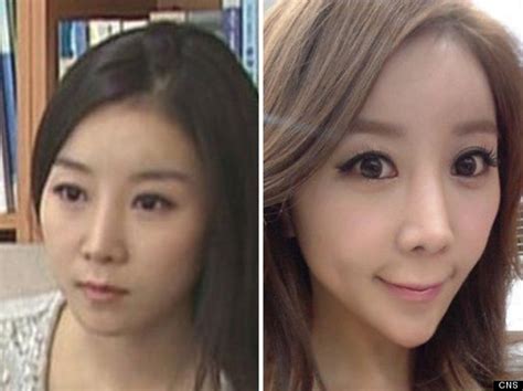 South Korea Plastic Surgery Trend One Tv Presenters Jaw Surgery For