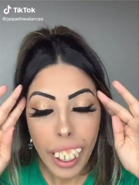 Truth About Jaqueline Alarcãos Viral Teeth Transformation In Tiktok