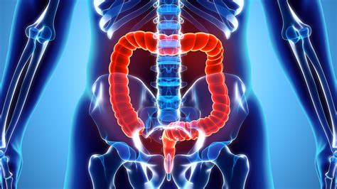 Colon Rectum Cancer Prognosis And Life Expectancy Best Gastro
