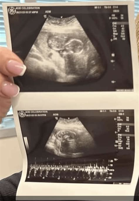is this a fake sonogram r scamandapodcast
