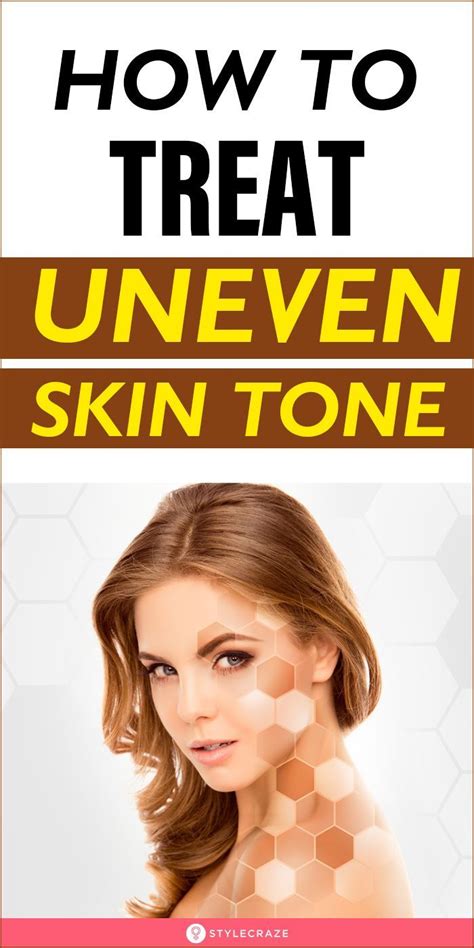Uneven Skin Tone Tips To Get Rid Of It Naturally In 2021 Uneven Skin