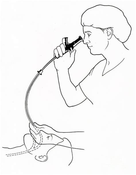 Illustration Of Endoscopy Photograph By Science Source Pixels