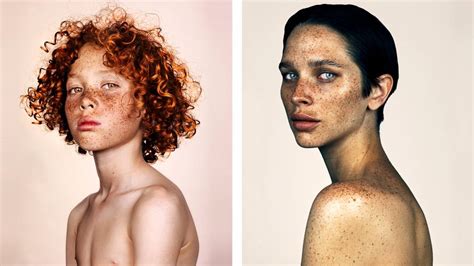 These Photos Will Make You Love Your Freckles Bbc Three