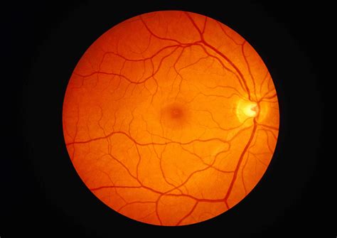 The Anatomy Of The Retina