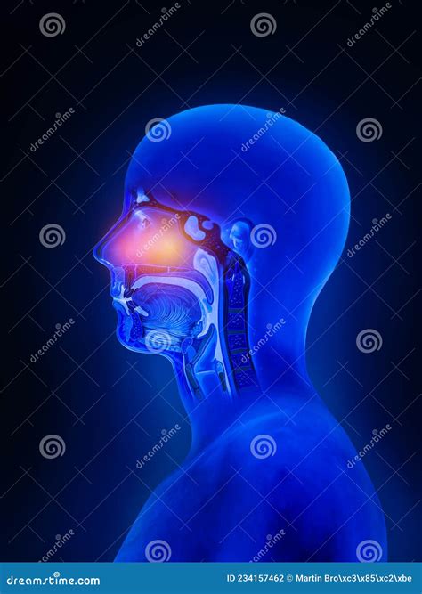 Sinusitis Of Human Skull With Inflamed At Sinus 3d Illustration
