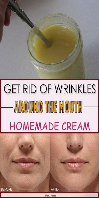 Get Rid Of Wrinkles Around The Mouth Homemade Cream Homemade Wrinkle
