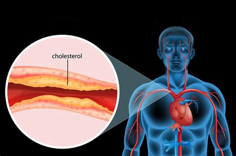 Wajib Anda Catat Berikut Kadar Kolesterol Normal Bagi Wanita Hits