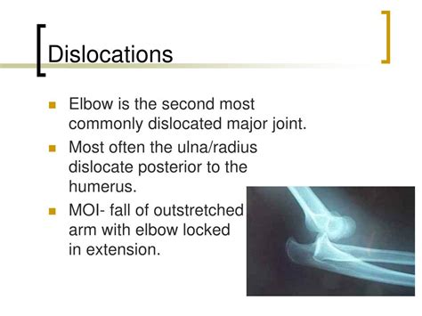 Ppt Elbow Joint Powerpoint Presentation Free Download Id645385