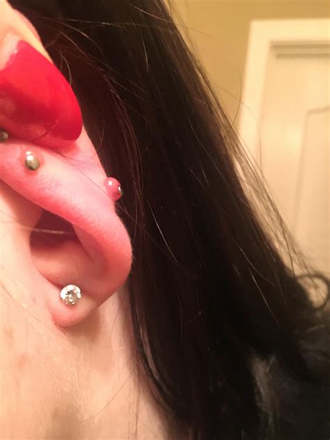 Just Noticed This Huge Bump On The Back Of My Conch Piercing Need Advice Piercing