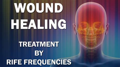 Wound Healing Rife Frequencies Treatment Energy And Quantum Medicine