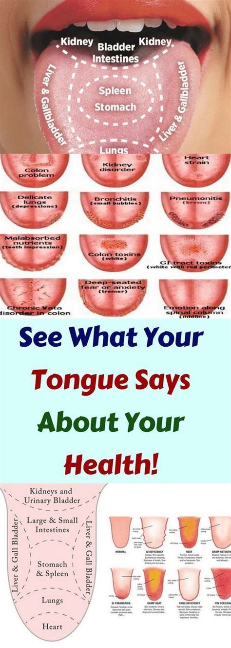 Health The Tongue Is A Very Useful Indicator Of Our Health And General