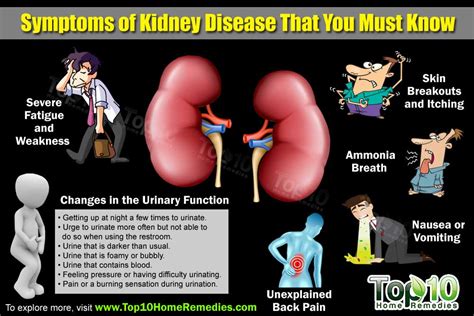 Top 10 Symptoms Of Kidney Disease That You Need To Know Top 10 Home