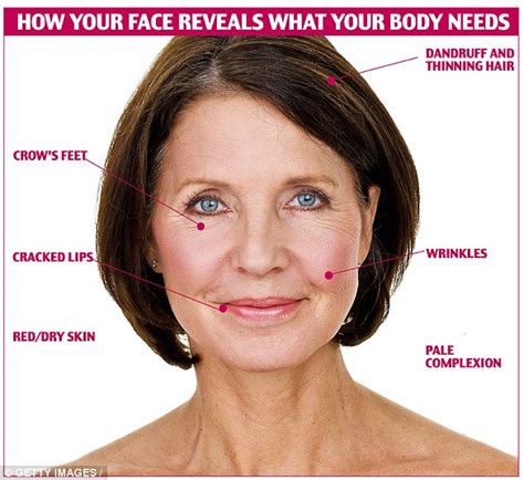 White Patches On Face Vitamin Deficiency Treatment