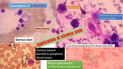 Giemsa Stain Introduction Preparation Principle Procedure And Result