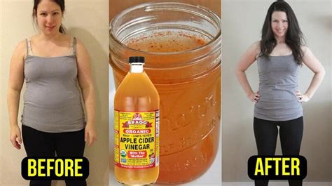 Gox, bitconnect, and even in canada with the mysterious shutdown of quadrigacx leaving everyone who had money in their. How To Use Apple Cider Vinegar For Belly Fat? - Ostomy ...