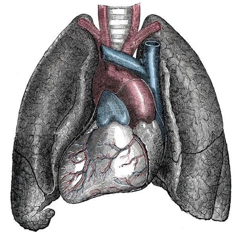 Dextrocardia Medicalopedia