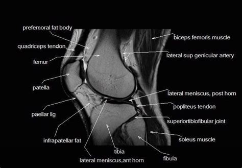 Click now to learn more about the bones, muscles, and soft tissues of these regions at leg and knee anatomy: MRI anatomy of the knee | Ortopedia y traumatologia ...