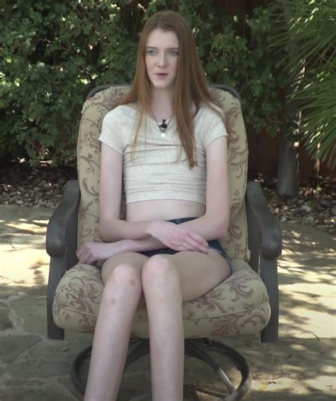 Texas Teen Wins Guinness World Record For The Longest Legs