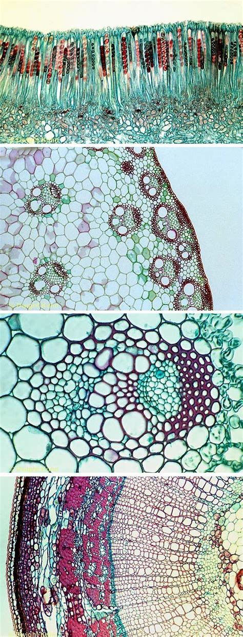 Download the perfect plant cell pictures. Microscopic plant cells | Coolest Things Ever | Pinterest ...