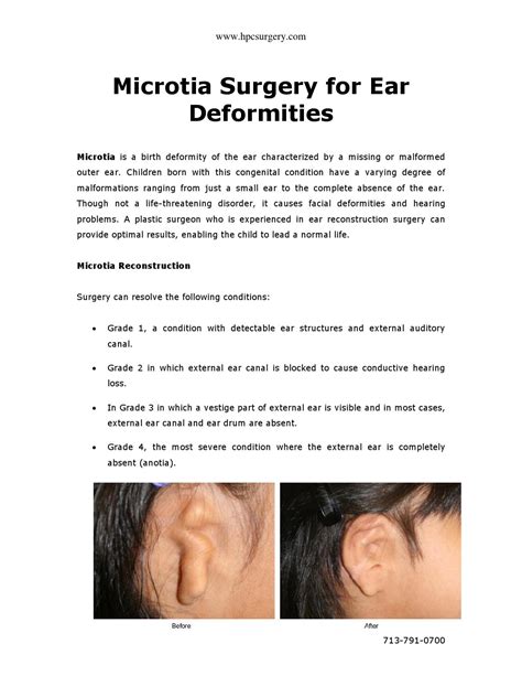 Microtia Surgery For Ear Deformities By Hpc Surgery Issuu