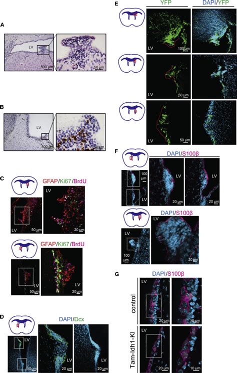 Expression Of Idh1r132h In The Murine Subventricular Zone Stem Cell
