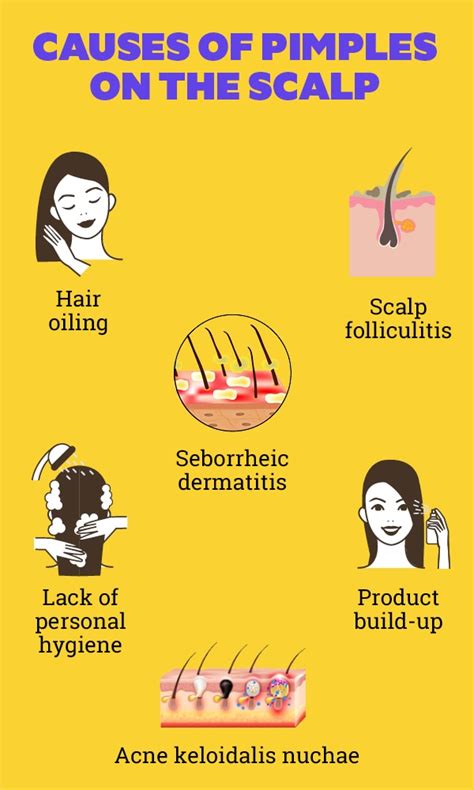 Causes Of Pimples On The Scalp And How To Treat Them 2022