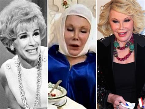 Joan Rivers Gets A Plastic Surgery ‘tune Up Orange County Register