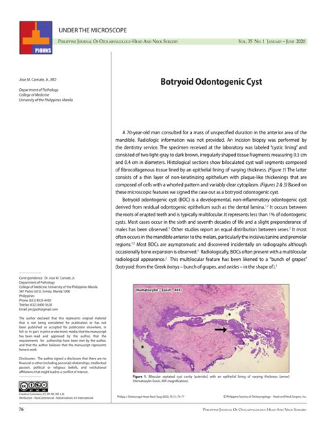 Pdf Botryoid Odontogenic Cyst