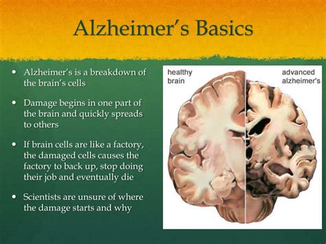 Ppt Alzheimers Disease Powerpoint Presentation Id2278217