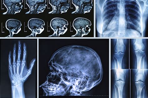 Diagnostic Imaging Technology X Ray Ct And Mri Scans