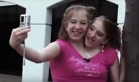The Twins Who Share A Body Watch Story Of Abigail And Brittany Hensel