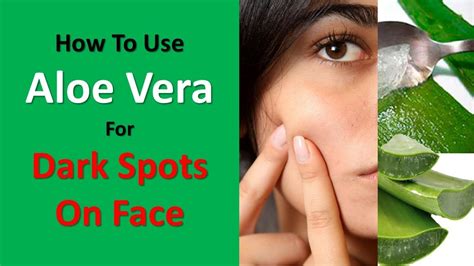 How To Use Aloe Vera For Dark Spots On Face Fresh Lemon Juice And