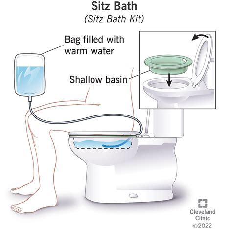 Sitz Bath Definition And Benefits