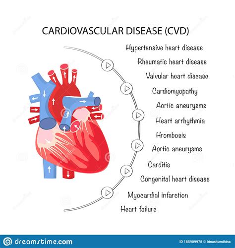 Diseases That Affect The Cardiovascular System Sciencehub
