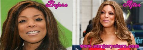 Wendy Williams Plastic Surgery Before And After Shoots