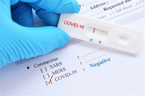 In addition to the gold standard pcr tests used to detect currently infected individuals, a number of alternative antigen and antibody tests are also in development. Test Covid / Coronavirus, où se faire tester pour voyager