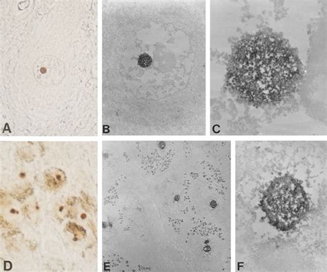 Electron Microscopic Immunohistochemical Features Of The Nuclear