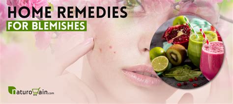 9 Best Home Remedies For Blemishes To Remove Acne Scars Naturally